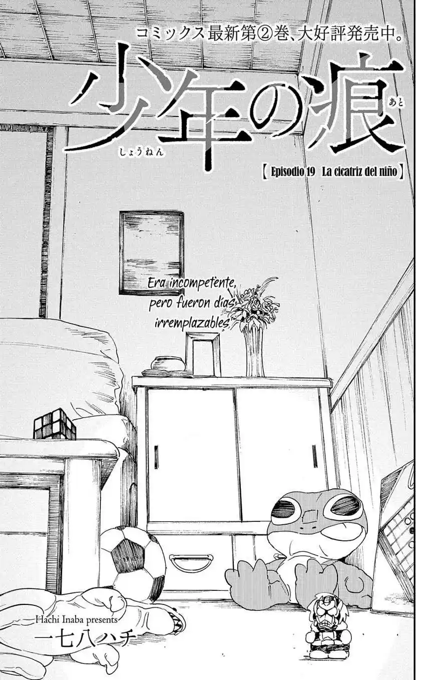 A Boy's Scar - Capítulo 19 - Página 4 - LectorTMOo
