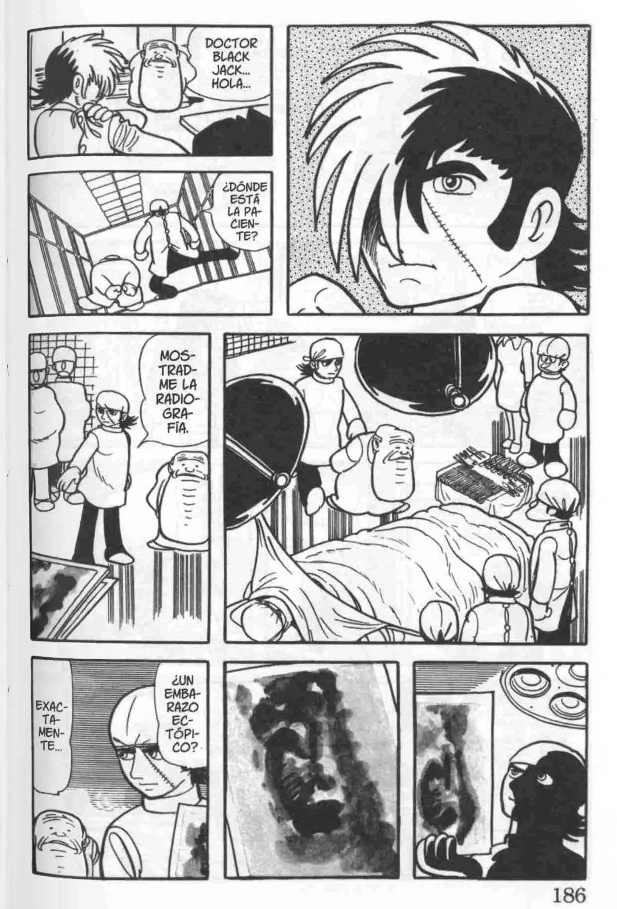Black Jack (1973) - Capítulo 21 - Página 6 - LectorTMOo